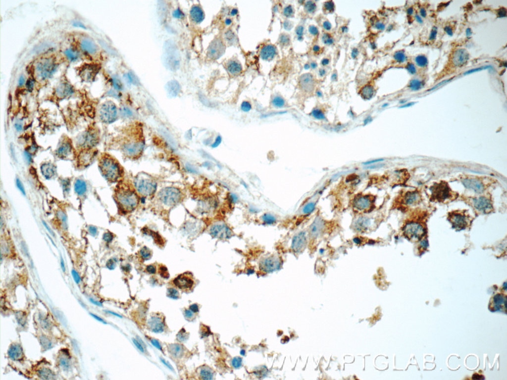 Immunohistochemistry (IHC) staining of human testis tissue using TCN1 Polyclonal antibody (16078-1-AP)