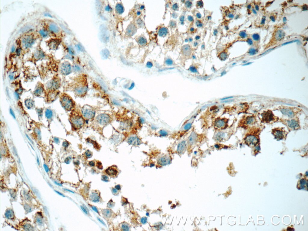 IHC staining of human testis using 16078-1-AP