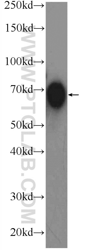 Western Blot (WB) analysis of human saliva using TCN1 Polyclonal antibody (16078-1-AP)