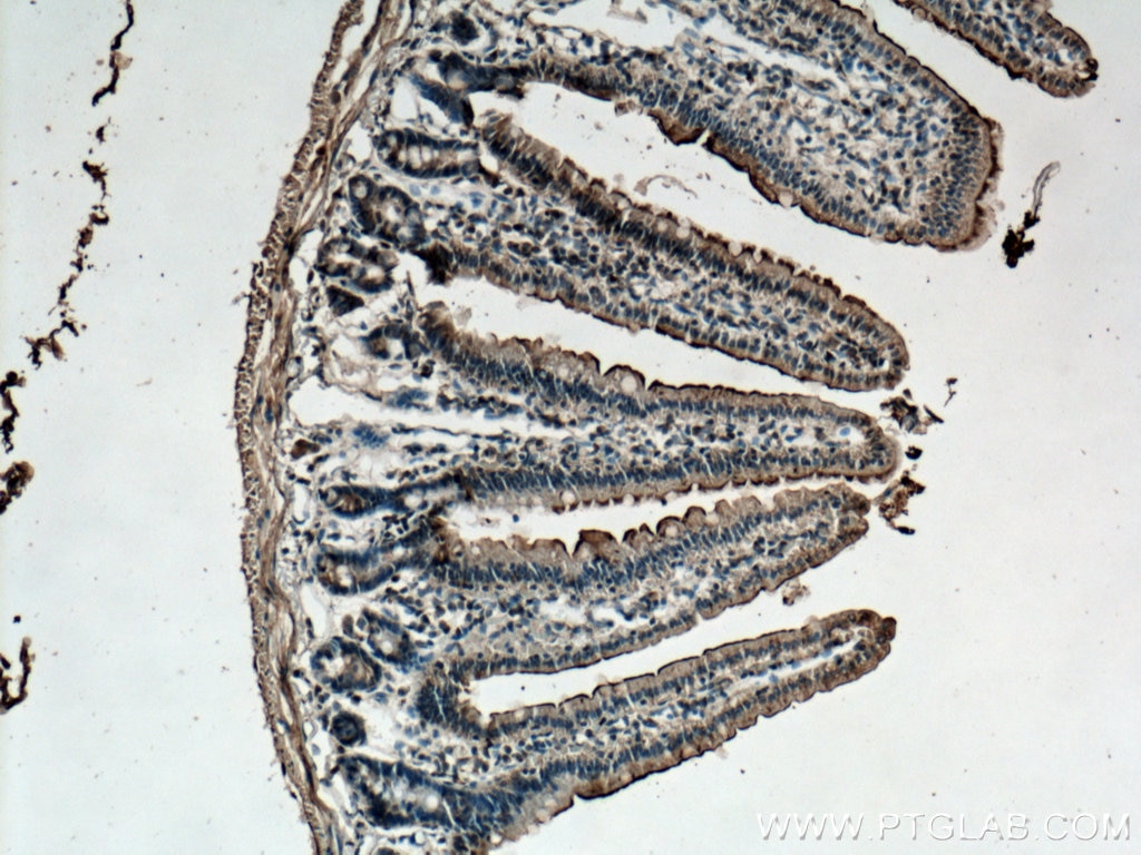 IHC staining of mouse small intestine using 12157-1-AP