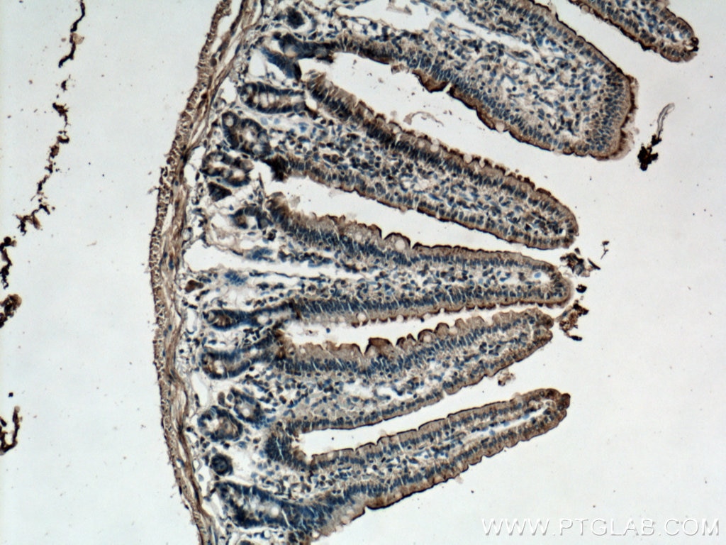 Immunohistochemistry (IHC) staining of mouse small intestine tissue using TCN2 Polyclonal antibody (12157-1-AP)