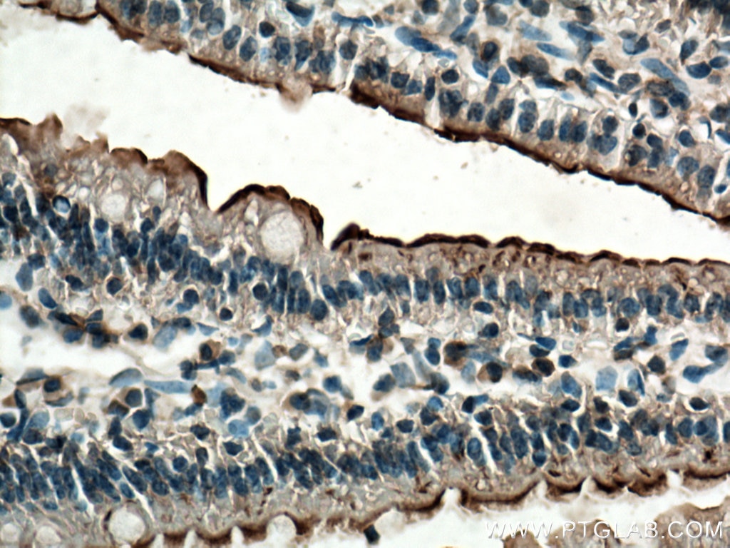 Immunohistochemistry (IHC) staining of mouse small intestine tissue using TCN2 Polyclonal antibody (12157-1-AP)