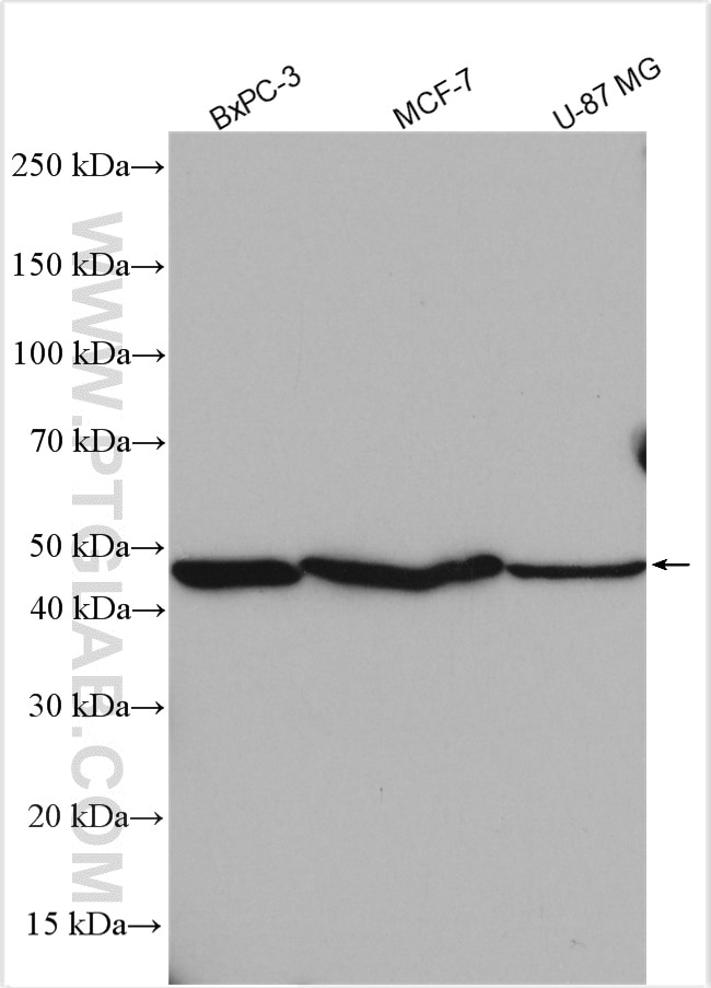Western Blot (WB) analysis of various lysates using TCN2 Polyclonal antibody (12157-1-AP)
