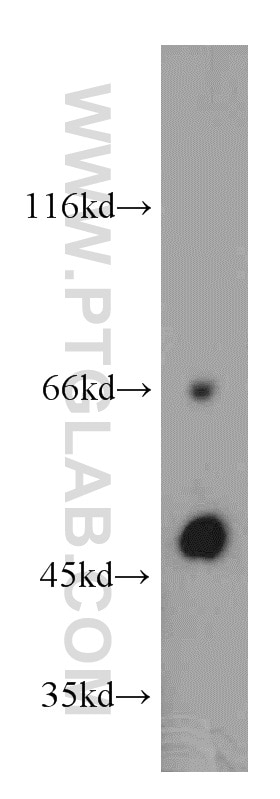 TCN2 Polyclonal antibody