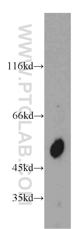 Western Blot (WB) analysis of rat liver tissue using TCN2 Polyclonal antibody (12157-1-AP)