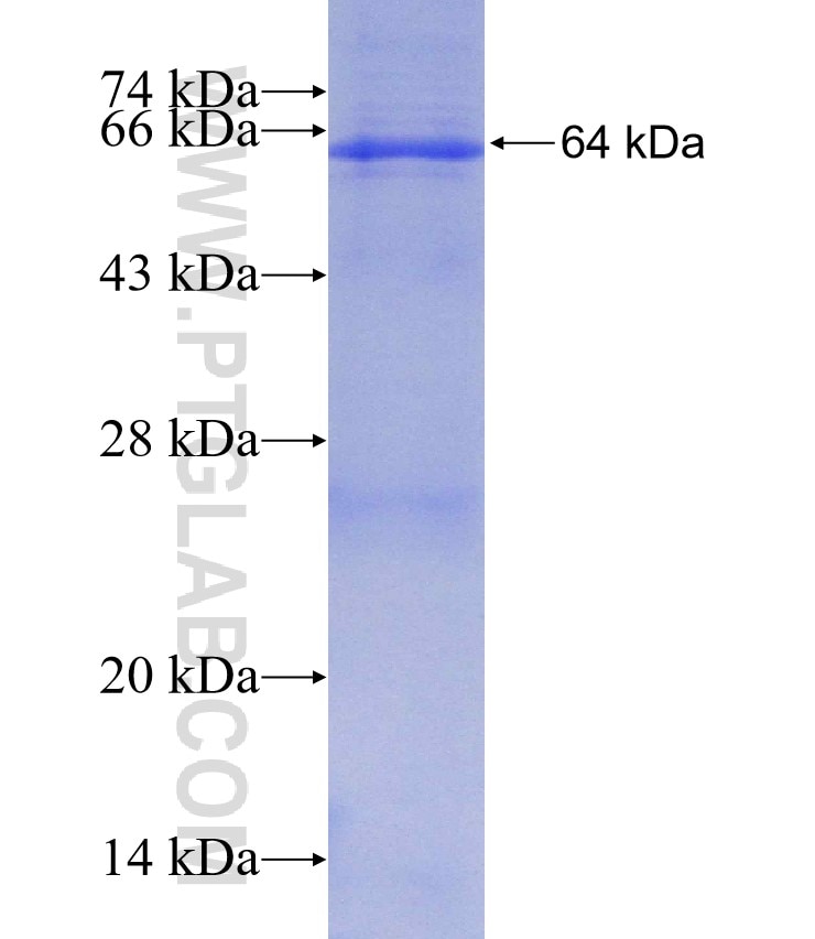 TCN2 fusion protein Ag2825 SDS-PAGE