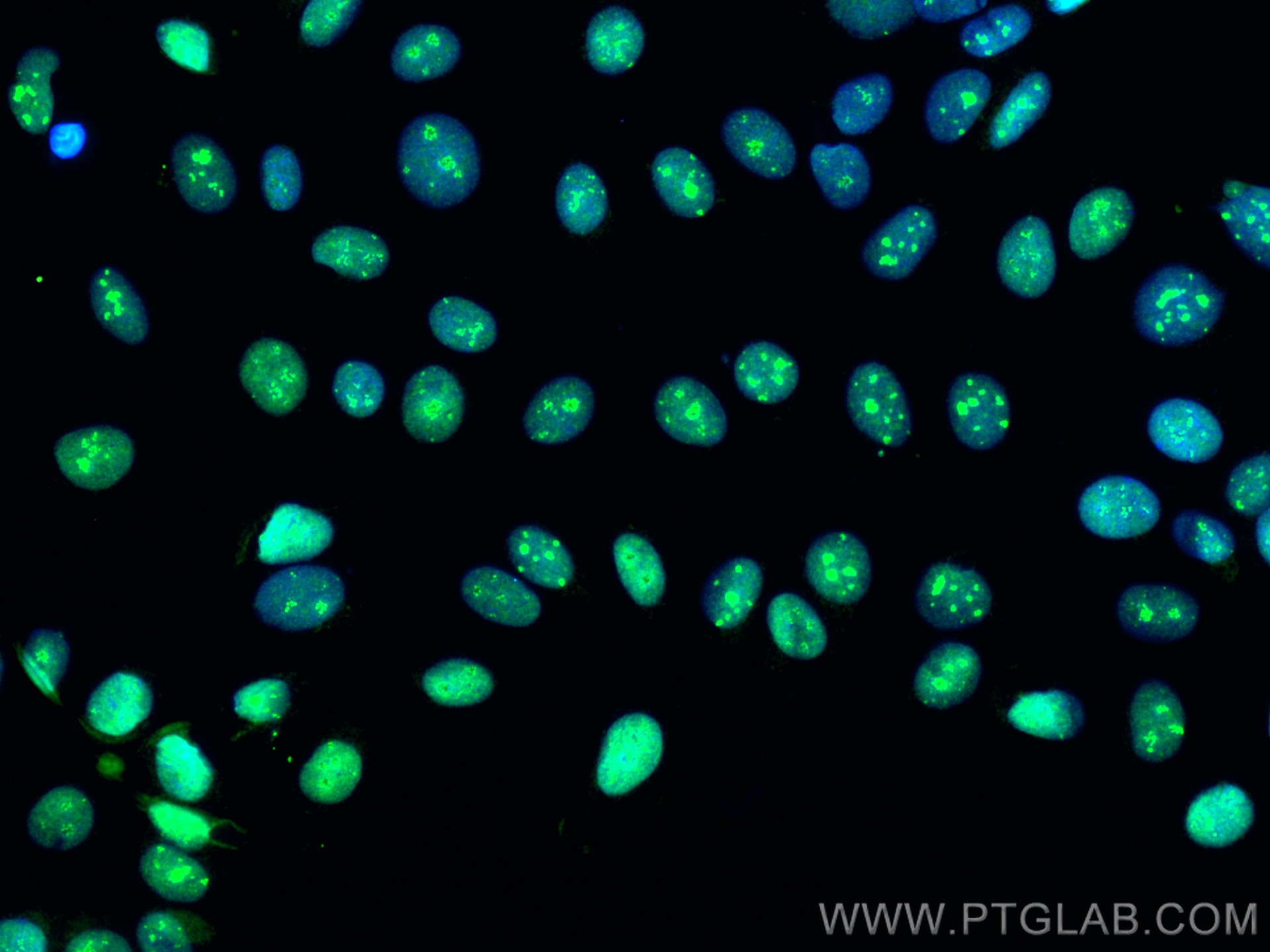 Immunofluorescence (IF) / fluorescent staining of MCF-7 cells using TCOF1 Polyclonal antibody (11003-1-AP)