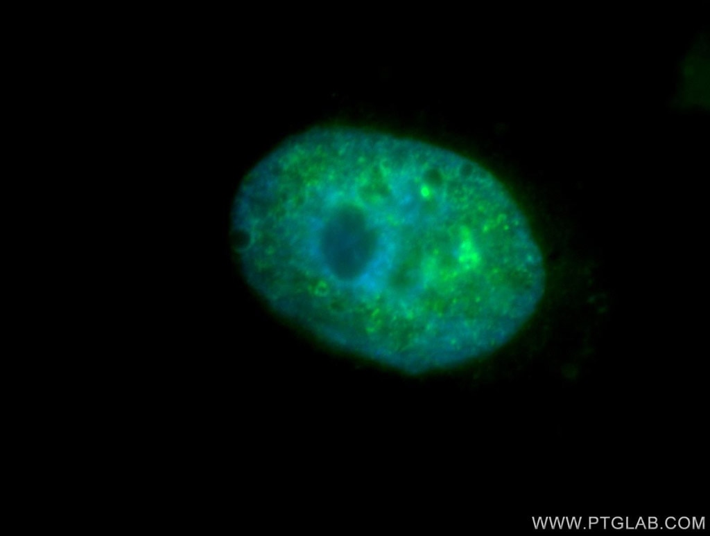 Immunofluorescence (IF) / fluorescent staining of MCF-7 cells using TCOF1 Polyclonal antibody (11003-1-AP)