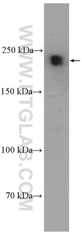 WB analysis of Neuro-2a using 11003-1-AP