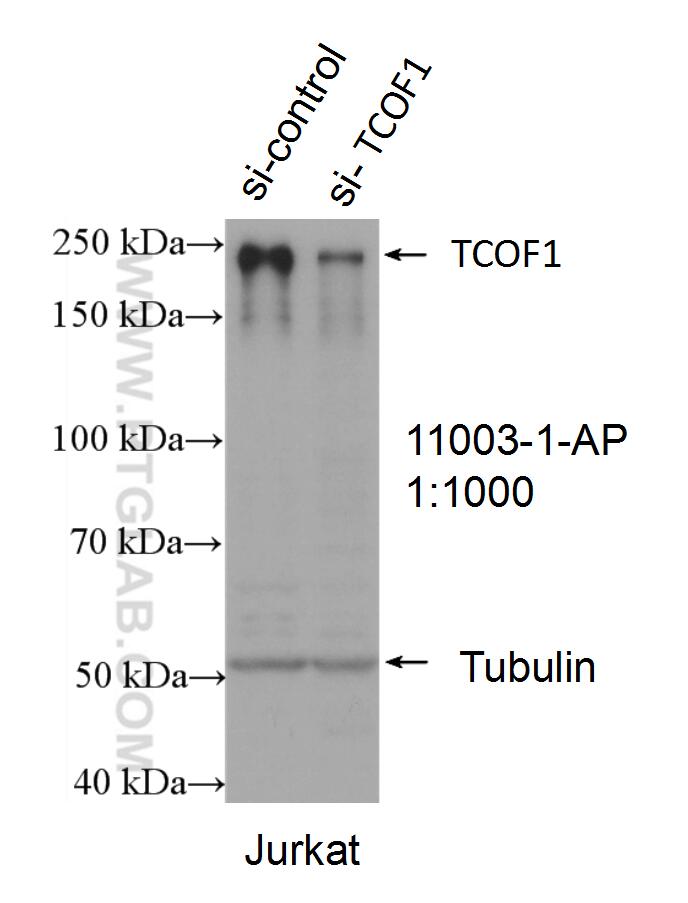 Western Blot (WB) analysis of Jurkat cells using TCOF1 Polyclonal antibody (11003-1-AP)