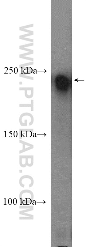 Western Blot (WB) analysis of Jurkat cells using TCOF1 Polyclonal antibody (11003-1-AP)