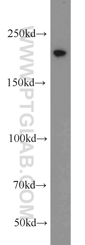 Western Blot (WB) analysis of HeLa cells using TCOF1 Polyclonal antibody (11003-1-AP)