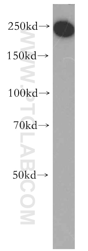 Western Blot (WB) analysis of HeLa cells using TCOF1 Polyclonal antibody (11003-1-AP)