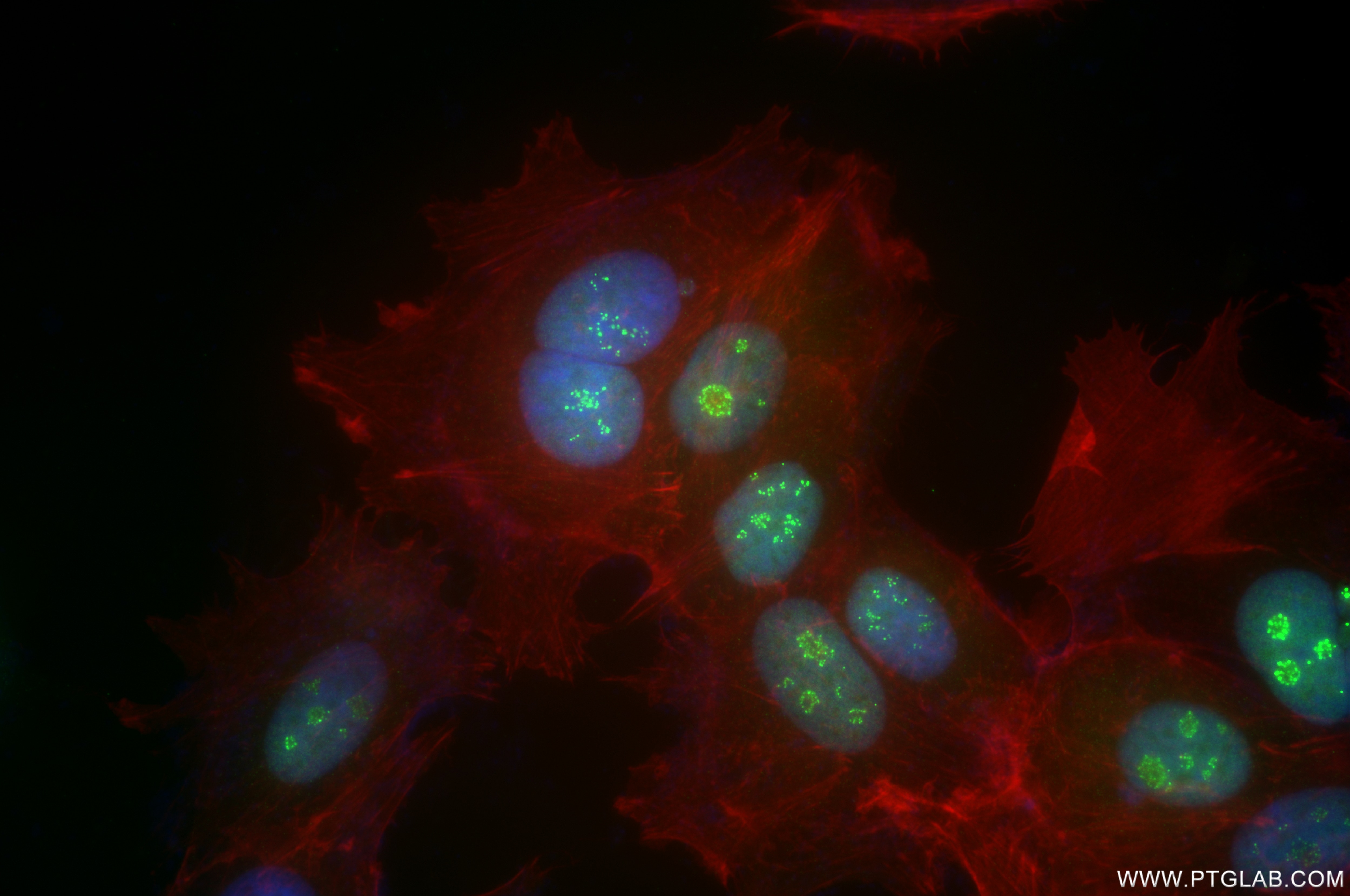 Immunofluorescence (IF) / fluorescent staining of MCF-7 cells using TCOF1 Recombinant antibody (84914-4-RR)