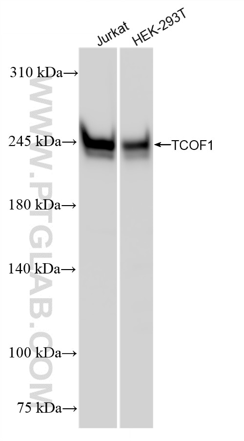 Western Blot (WB) analysis of various lysates using TCOF1 Recombinant antibody (84914-4-RR)