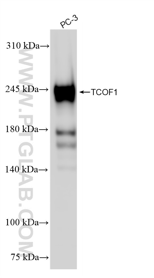 TCOF1