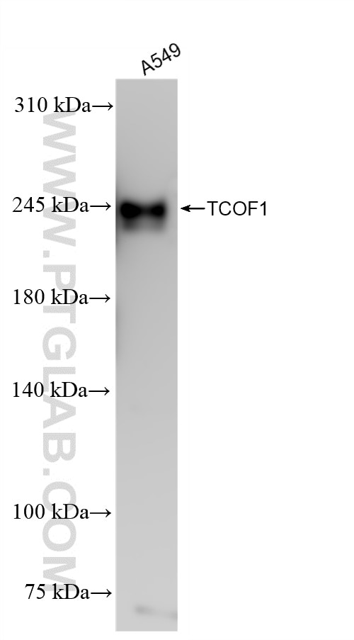 Western Blot (WB) analysis of A549 cells using TCOF1 Recombinant antibody (84914-4-RR)