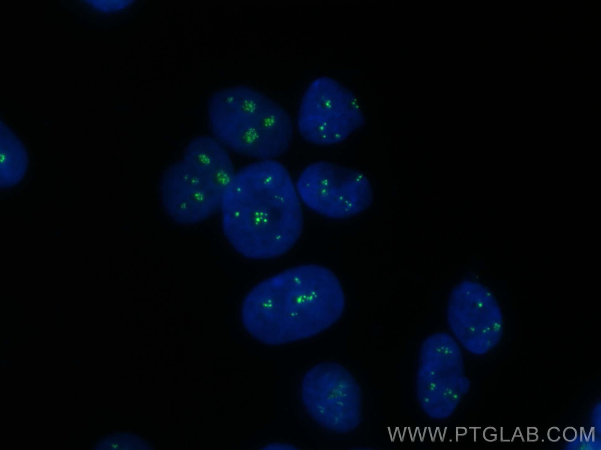 Immunofluorescence (IF) / fluorescent staining of MCF-7 cells using CoraLite® Plus 488-conjugated TCOF1 Polyclonal ant (CL488-11003)