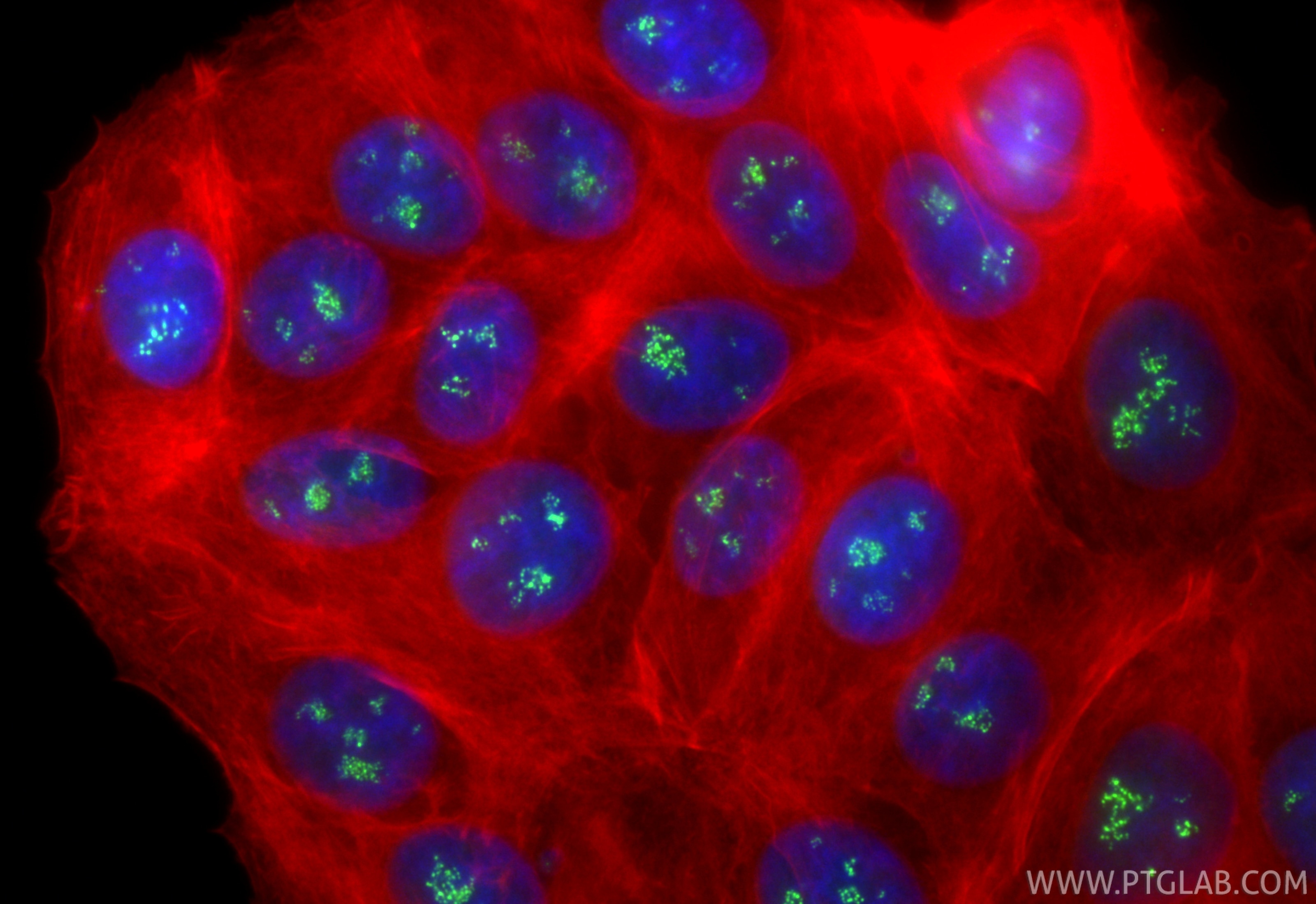 Immunofluorescence (IF) / fluorescent staining of MCF-7 cells using CoraLite® Plus 488-conjugated TCOF1 Recombinant an (CL488-84914-4)