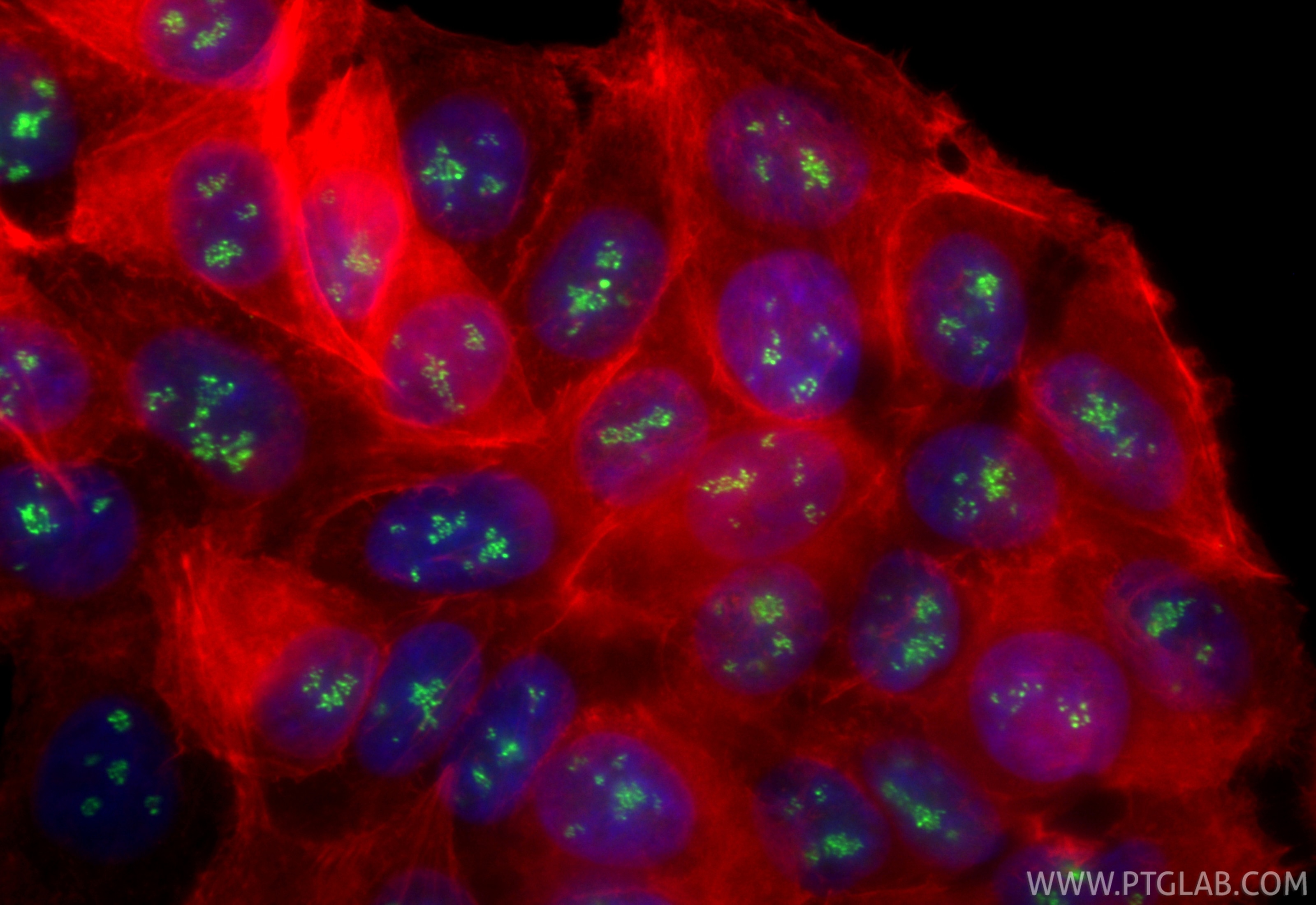 Immunofluorescence (IF) / fluorescent staining of MCF-7 cells using CoraLite® Plus 488-conjugated TCOF1 Recombinant an (CL488-84914-5)