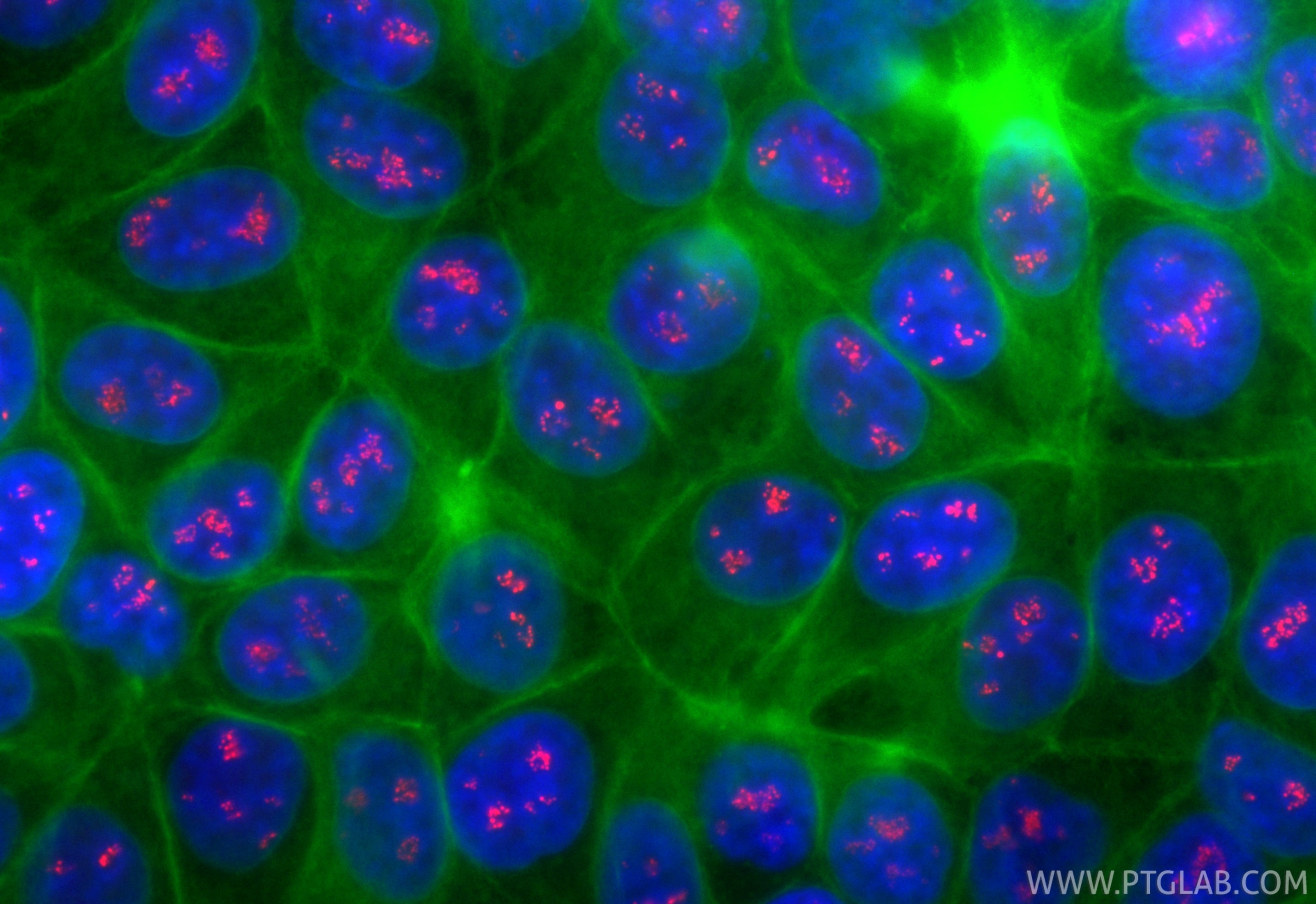 Immunofluorescence (IF) / fluorescent staining of MCF-7 cells using CoraLite®594-conjugated TCOF1 Recombinant antibody (CL594-84914-4)
