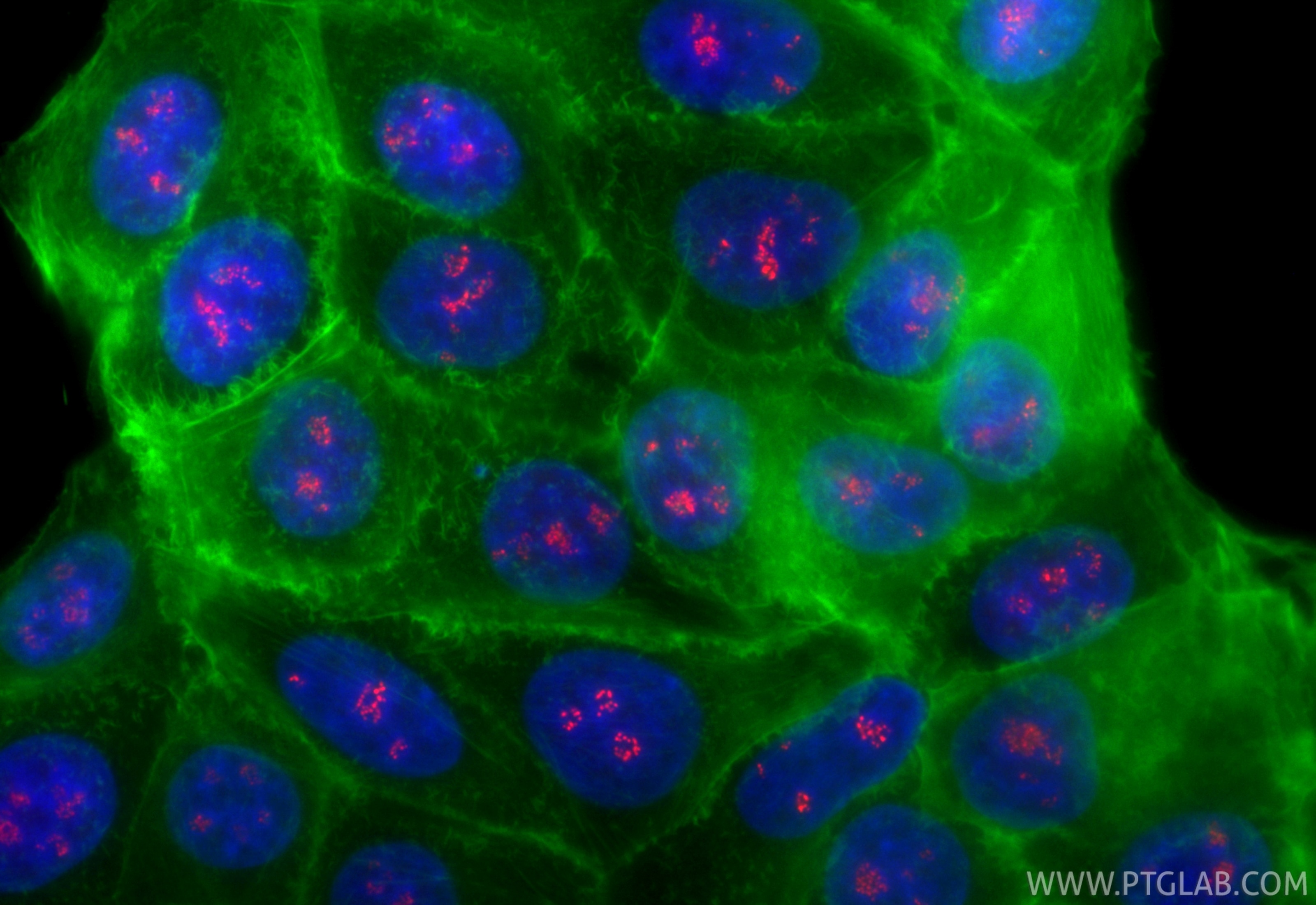 Immunofluorescence (IF) / fluorescent staining of MCF-7 cells using CoraLite®594-conjugated TCOF1 Recombinant antibody (CL594-84914-5)