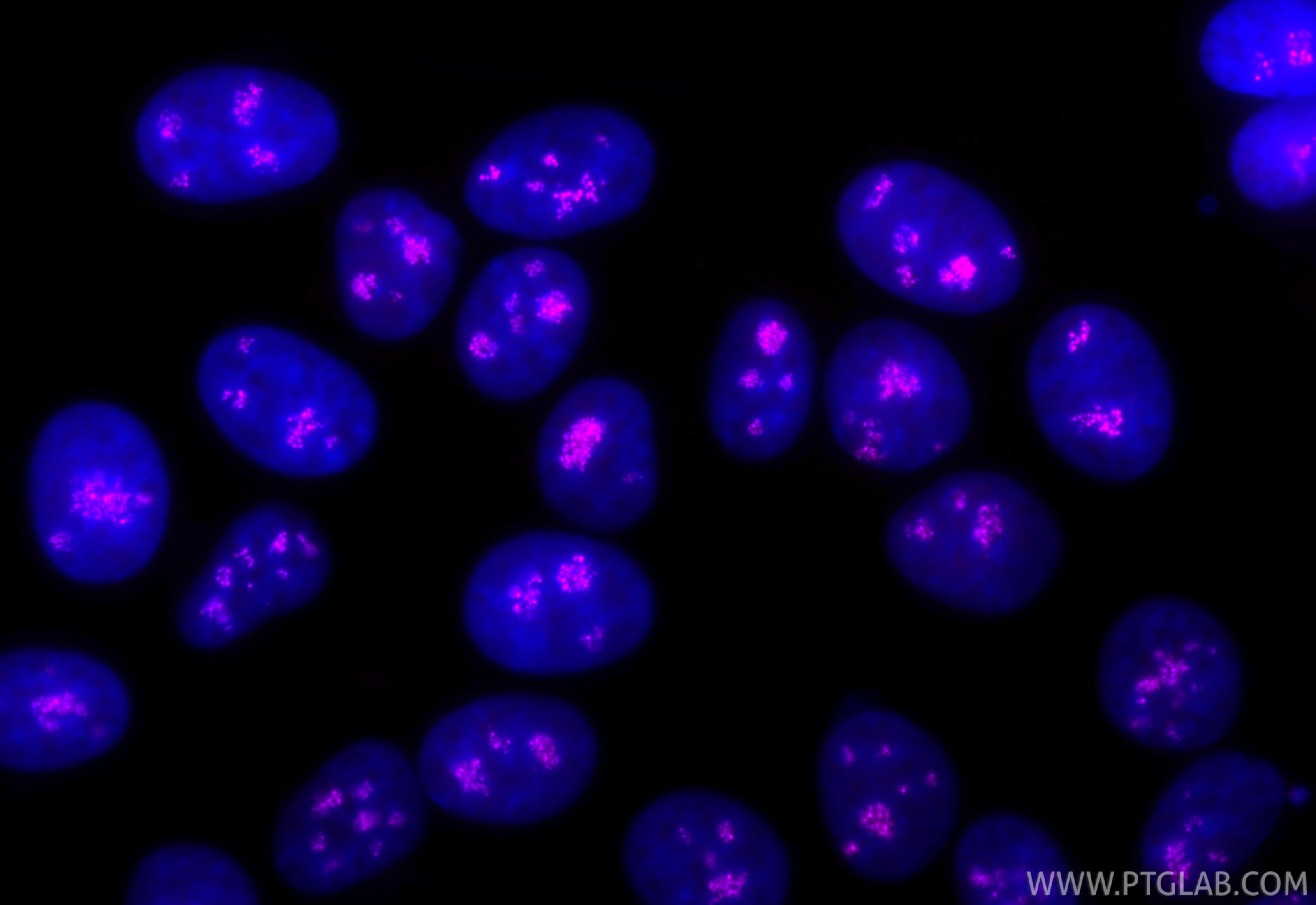 Immunofluorescence (IF) / fluorescent staining of MCF-7 cells using CoraLite® Plus 647-conjugated TCOF1 Recombinant an (CL647-84914-4)
