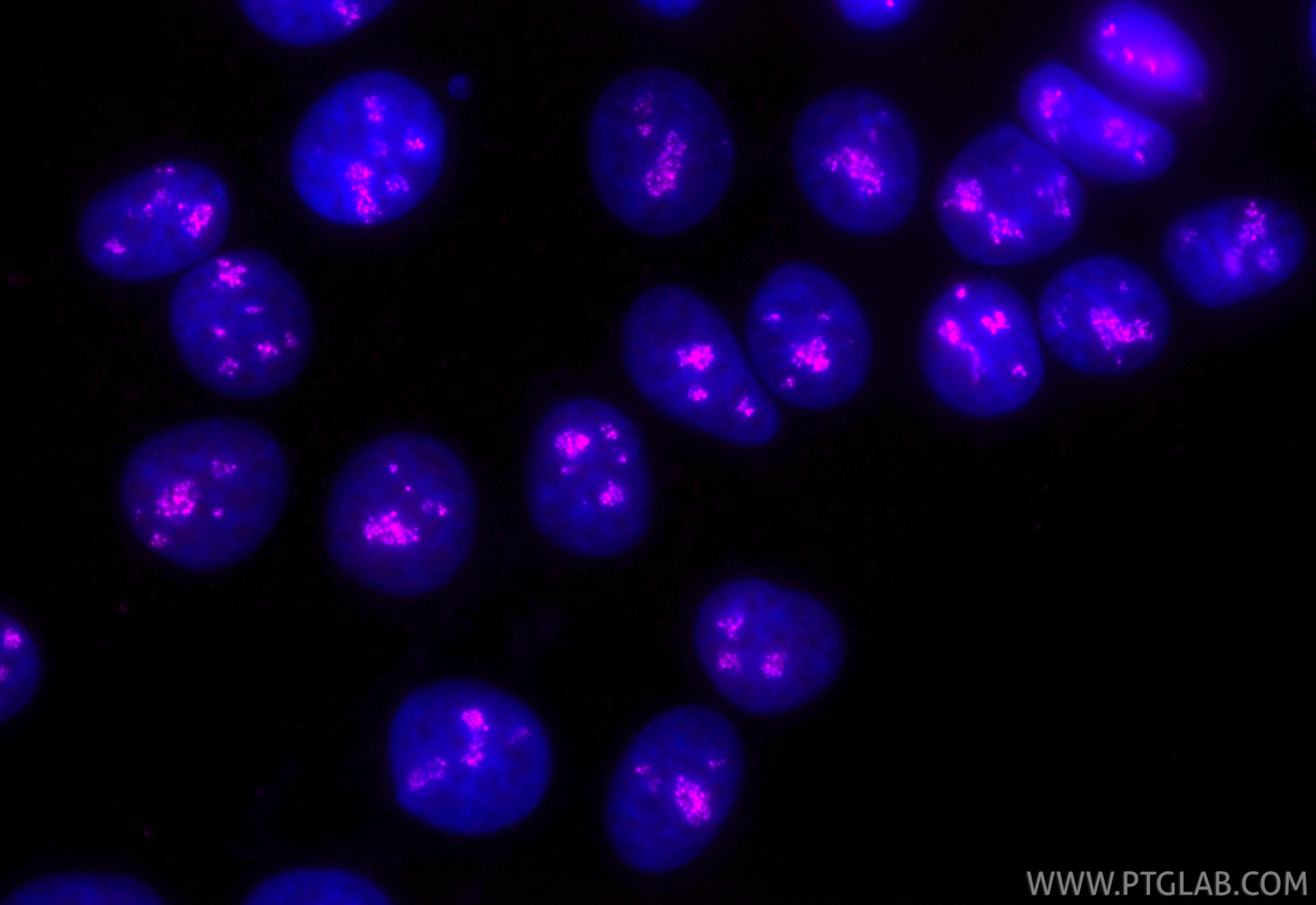 Immunofluorescence (IF) / fluorescent staining of MCF-7 cells using CoraLite® Plus 647-conjugated TCOF1 Recombinant an (CL647-84914-5)