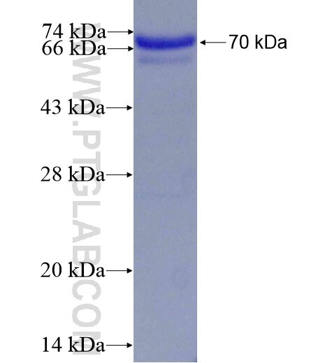 TCOF1 fusion protein Ag1447 SDS-PAGE