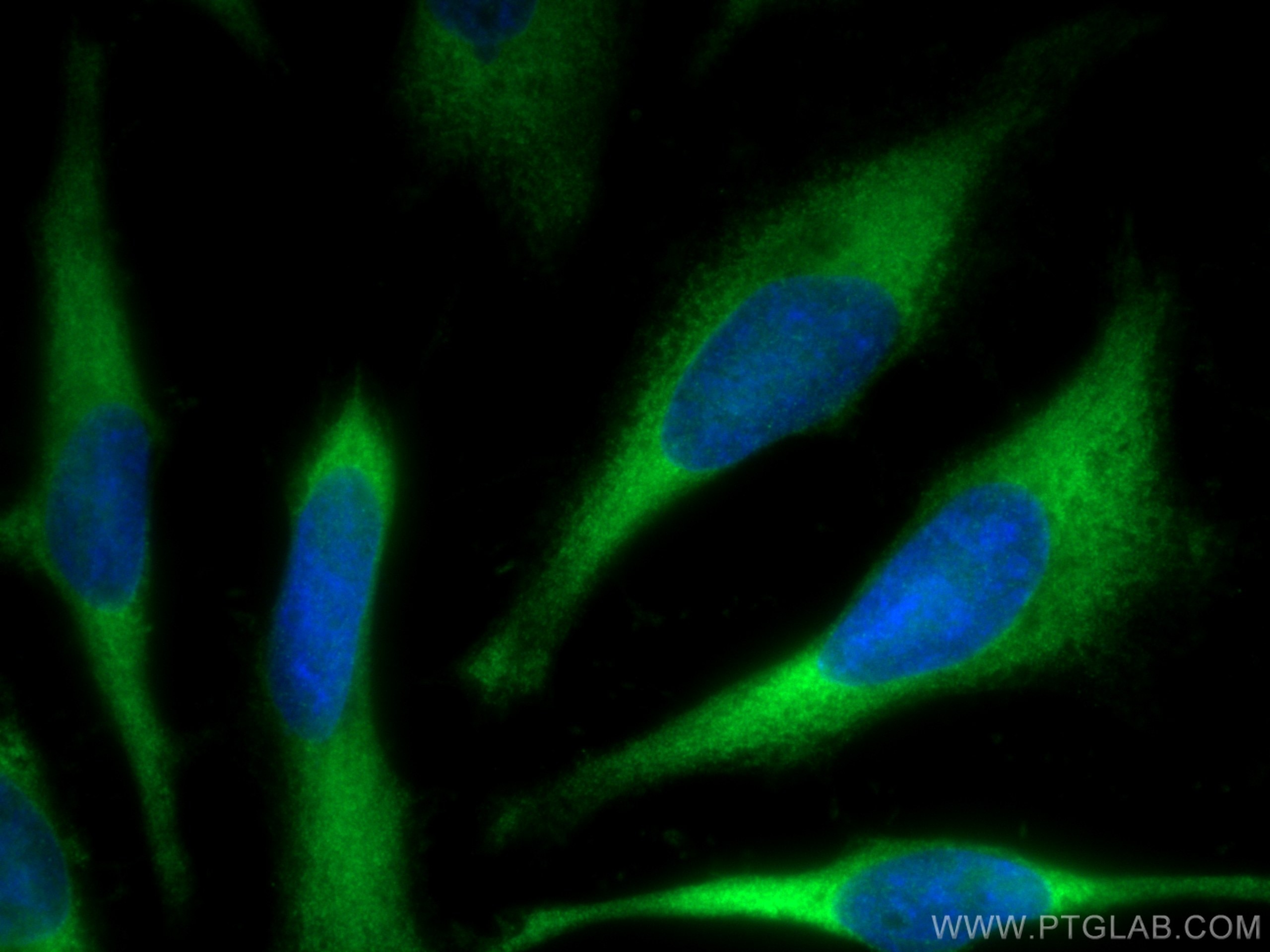 Immunofluorescence (IF) / fluorescent staining of HeLa cells using TCP1 Polyclonal antibody (10320-1-AP)
