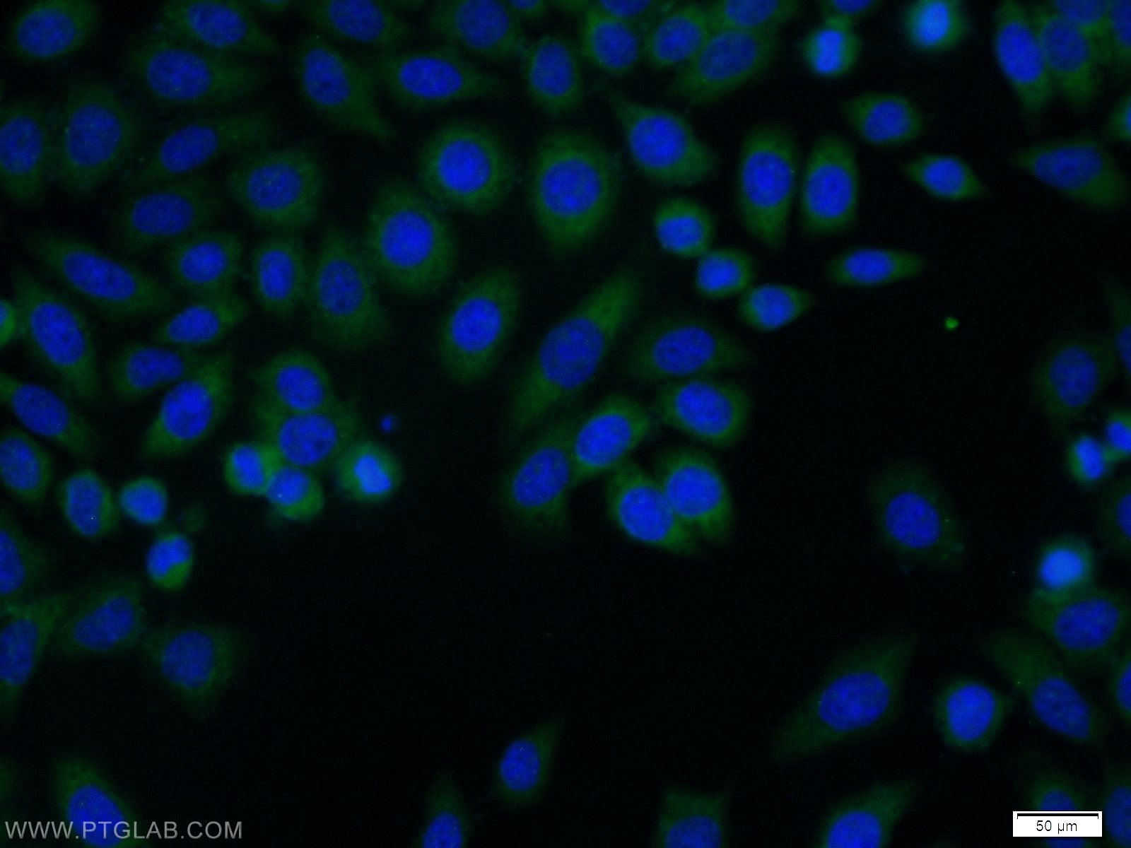 Immunofluorescence (IF) / fluorescent staining of MCF-7 cells using TCP1 Polyclonal antibody (10320-1-AP)