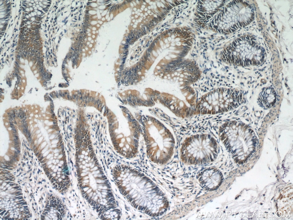 Immunohistochemistry (IHC) staining of human colon tissue using TCP1 Polyclonal antibody (10320-1-AP)