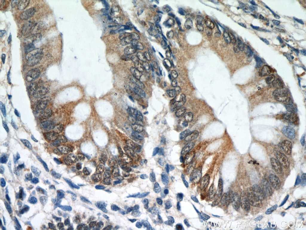 Immunohistochemistry (IHC) staining of human colon tissue using TCP1 Polyclonal antibody (10320-1-AP)