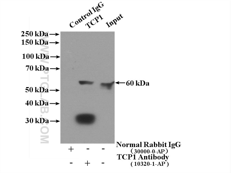 Immunoprecipitation (IP) experiment of HeLa cells using TCP1 Polyclonal antibody (10320-1-AP)