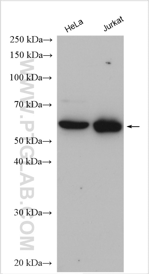 Western Blot (WB) analysis of various lysates using TCP1 Polyclonal antibody (10320-1-AP)