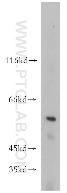 Western Blot (WB) analysis of HeLa cells using TCP1 Polyclonal antibody (10320-1-AP)