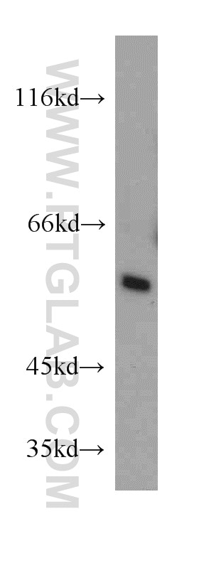 Western Blot (WB) analysis of Jurkat cells using TCP1 Polyclonal antibody (10320-1-AP)