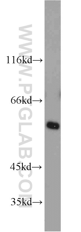 Western Blot (WB) analysis of mouse heart tissue using TCP1 Polyclonal antibody (10320-1-AP)