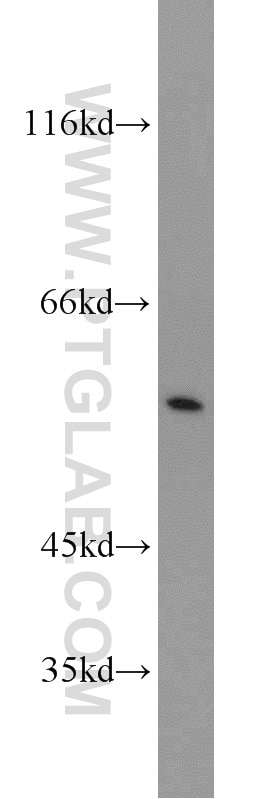 Western Blot (WB) analysis of MCF-7 cells using TCP1 Polyclonal antibody (10320-1-AP)