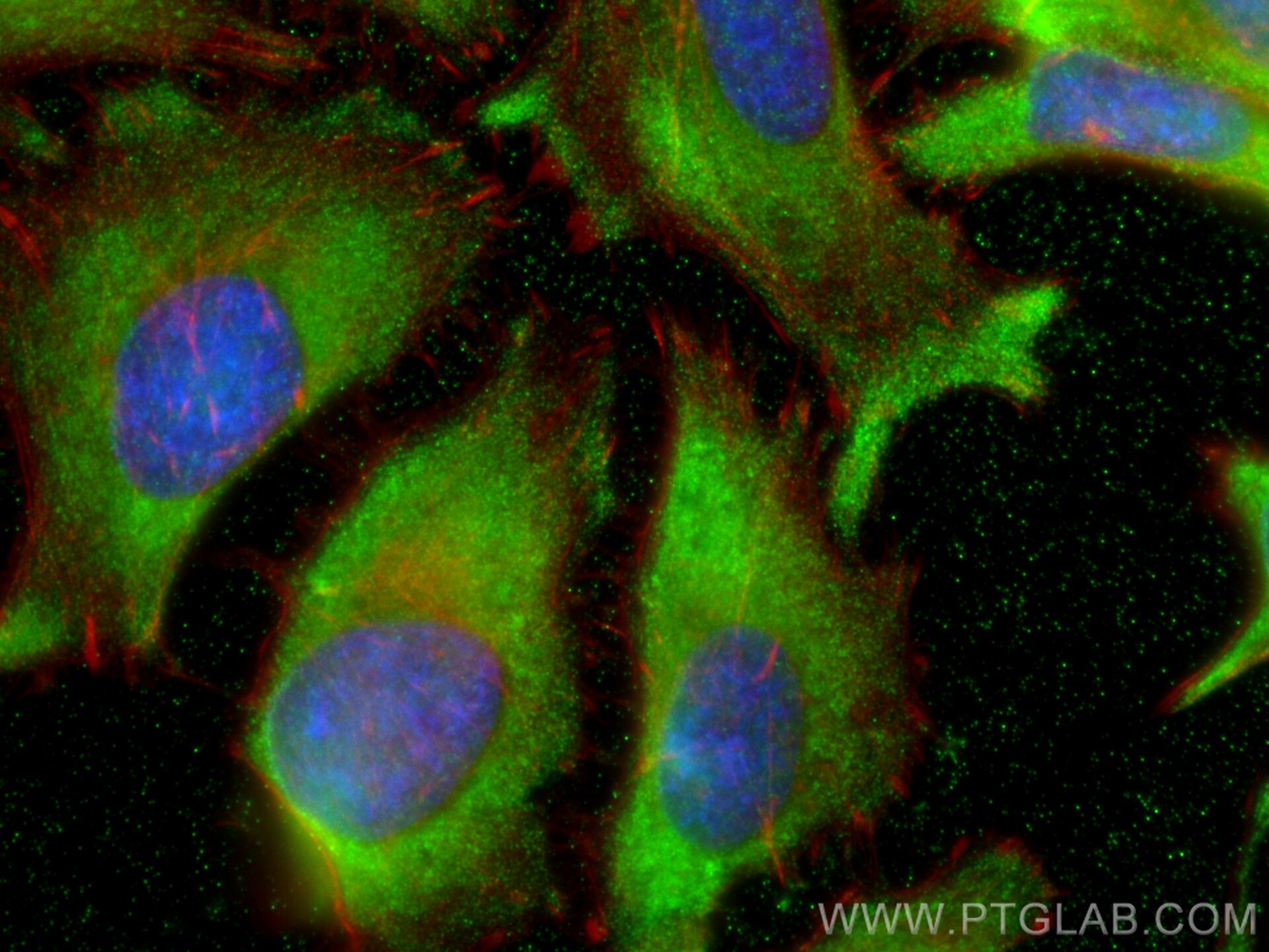 Immunofluorescence (IF) / fluorescent staining of HeLa cells using TCP1 Monoclonal antibody (68183-1-Ig)