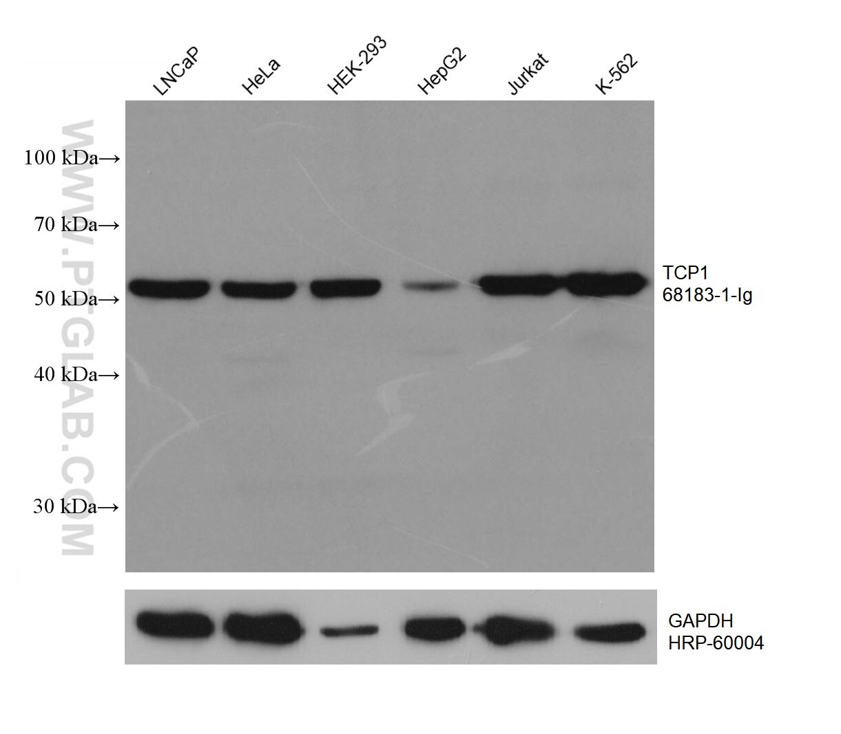 Western Blot (WB) analysis of various lysates using TCP1 Monoclonal antibody (68183-1-Ig)