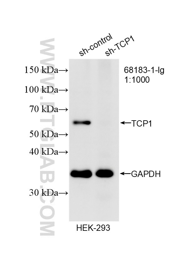 Western Blot (WB) analysis of HEK-293 cells using TCP1 alpha Monoclonal antibody (68183-1-Ig)