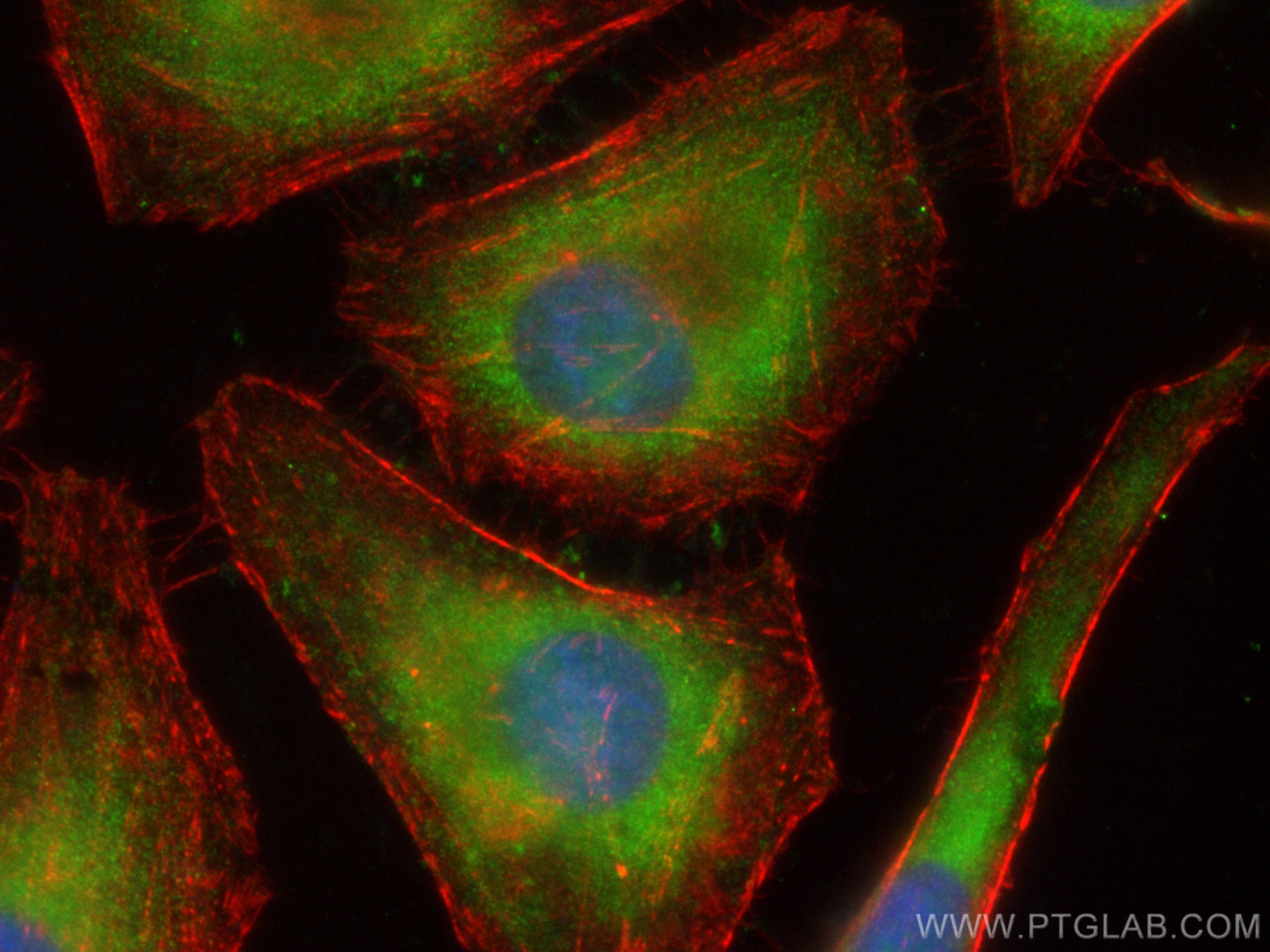 Immunofluorescence (IF) / fluorescent staining of HeLa cells using CoraLite® Plus 488-conjugated TCP1 Polyclonal anti (CL488-10320)