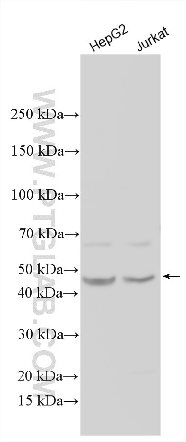 Western Blot (WB) analysis of various lysates using TCP10 Polyclonal antibody (14538-1-AP)