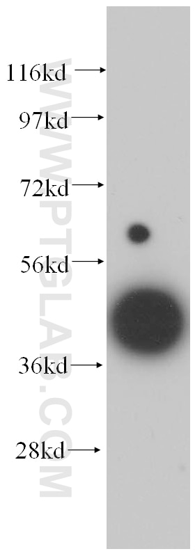 Western Blot (WB) analysis of HeLa cells using TCP10 Polyclonal antibody (14538-1-AP)