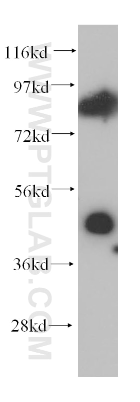 Western Blot (WB) analysis of mouse testis tissue using TCP10 Polyclonal antibody (14538-1-AP)