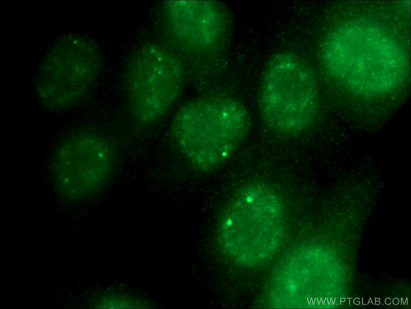 Immunofluorescence (IF) / fluorescent staining of HeLa cells using TCP10L Polyclonal antibody (13709-1-AP)