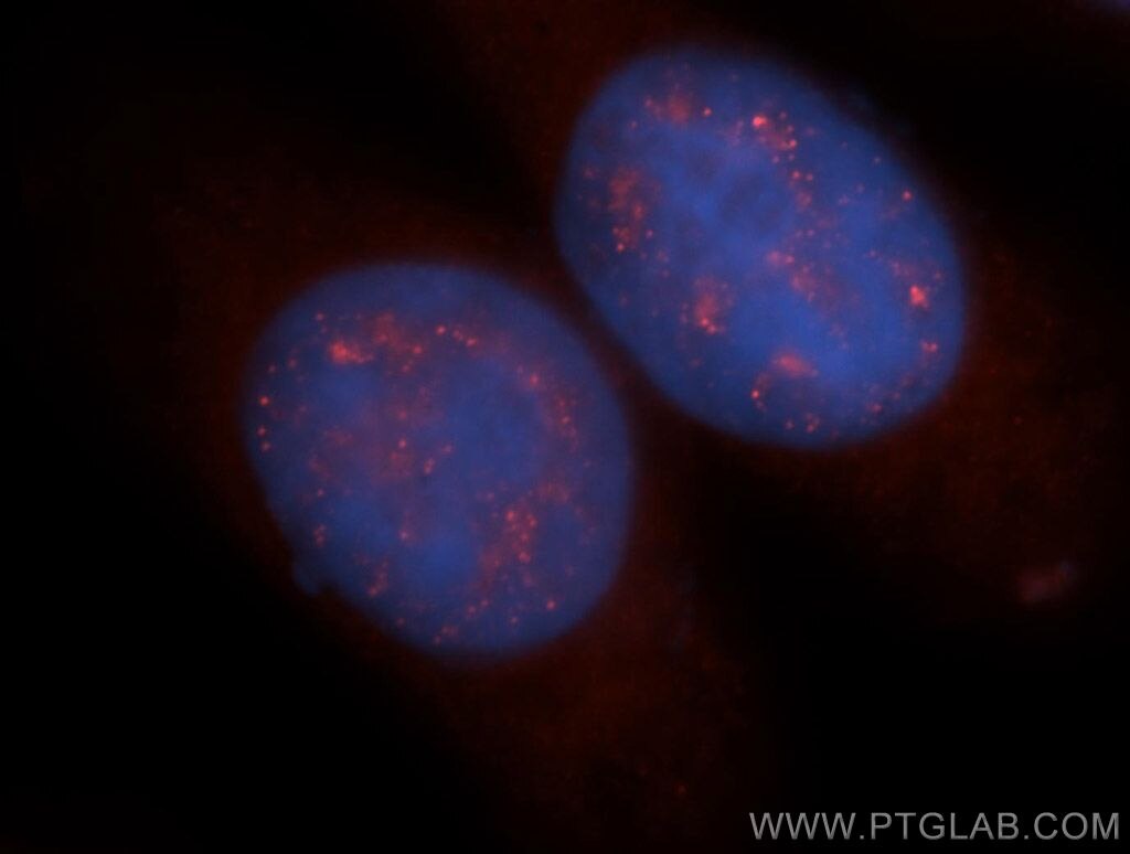 IF Staining of HeLa using 13709-1-AP