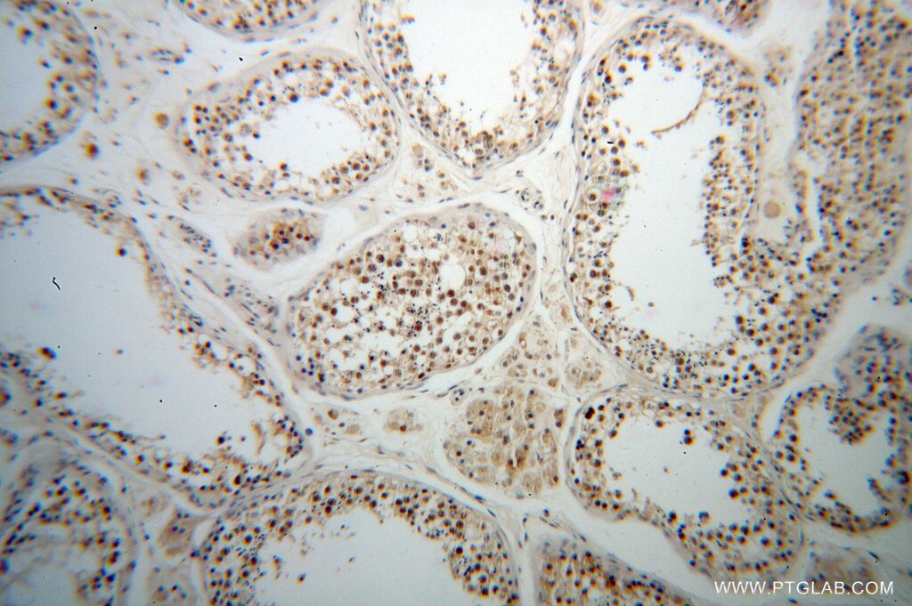 Immunohistochemistry (IHC) staining of human testis tissue using TCP10L Polyclonal antibody (13709-1-AP)