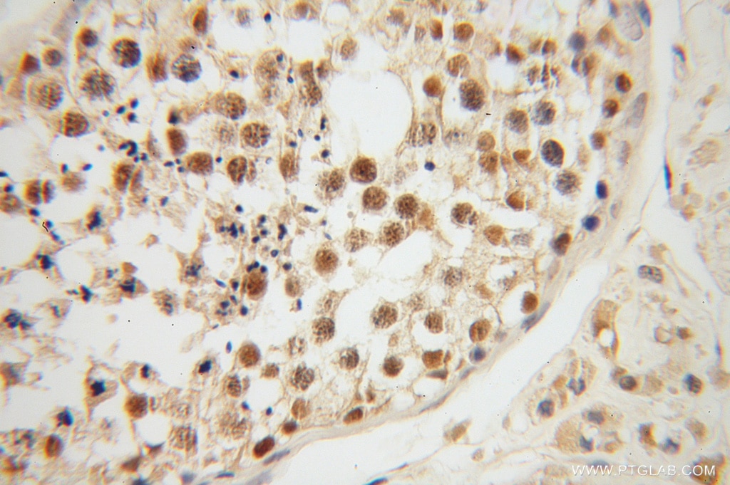 Immunohistochemistry (IHC) staining of human testis tissue using TCP10L Polyclonal antibody (13709-1-AP)